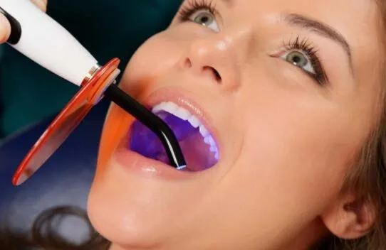 Пломбування зубів