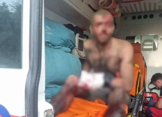 На Харківщині підірвався на невідомому пристрої - йому відірвало частину руки