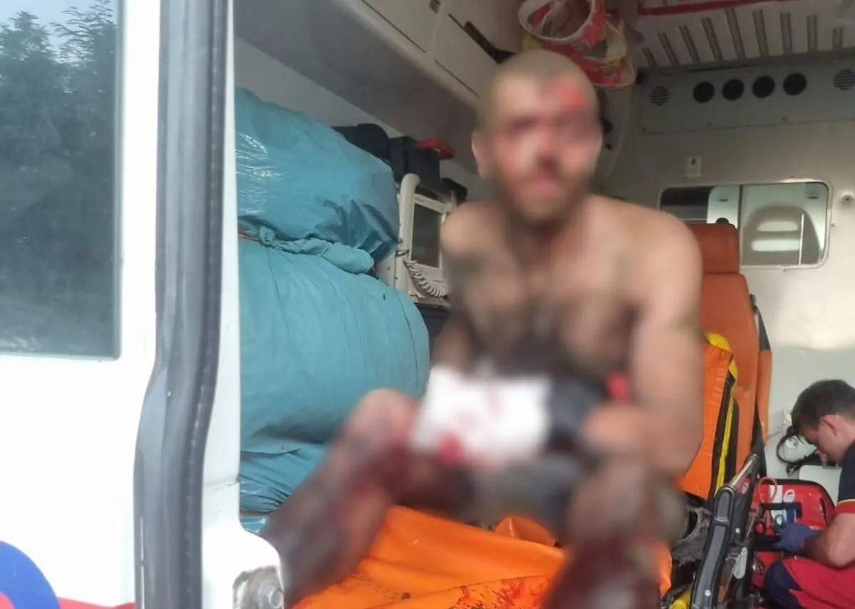 На Харківщині підірвався на невідомому пристрої - йому відірвало частину руки